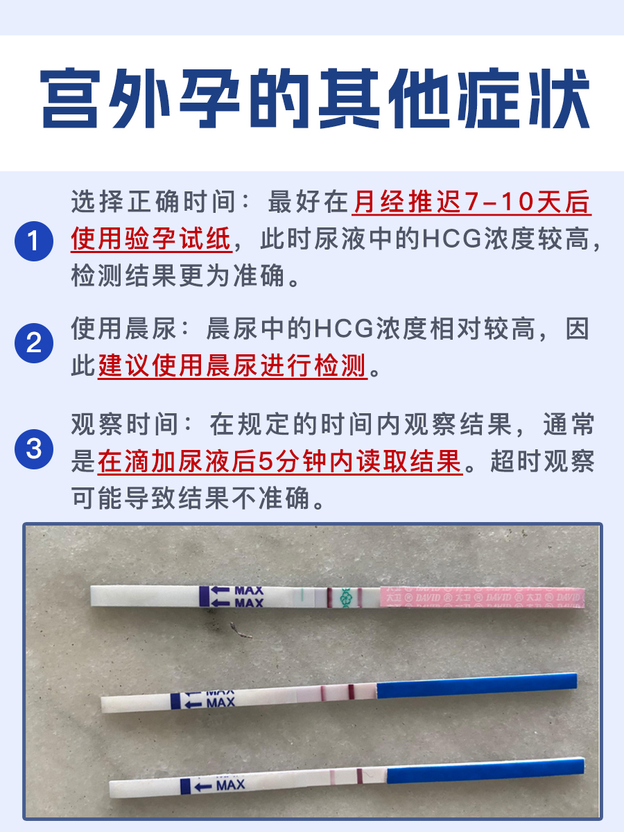 一文了解：宫外孕会是一条杠吗？