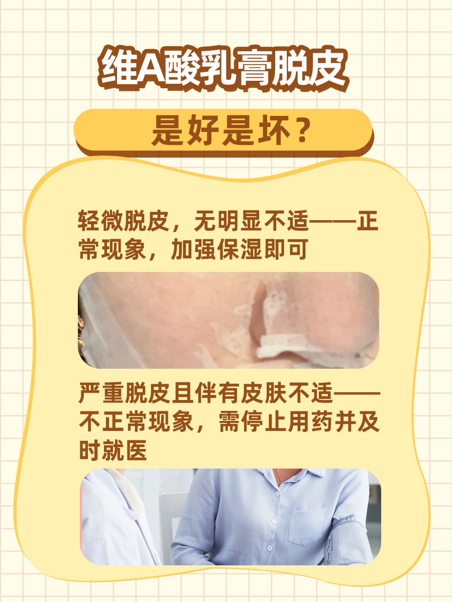 维A酸乳膏使用后脱皮，是好现象还是坏兆头？
