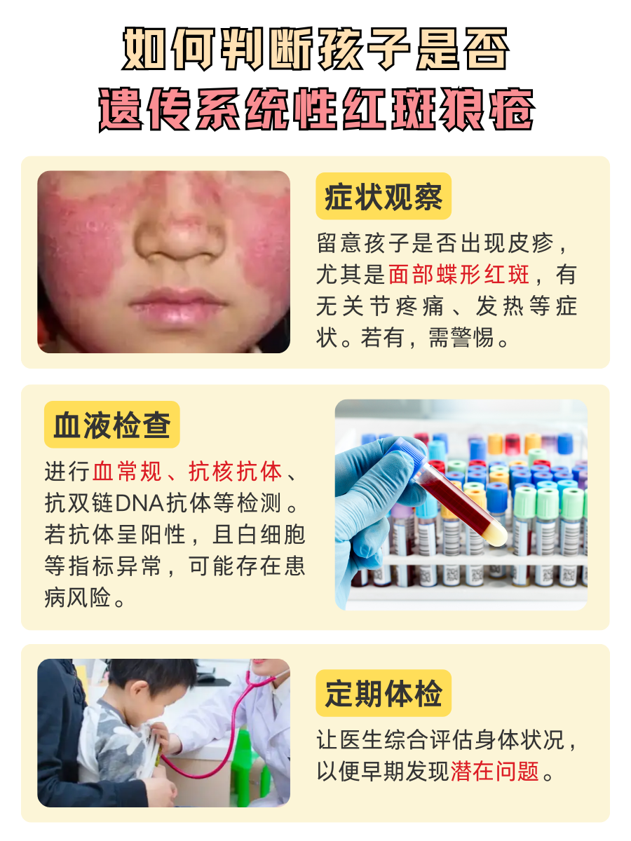 揪心！系统性红斑狼疮会遗传给孩子吗？