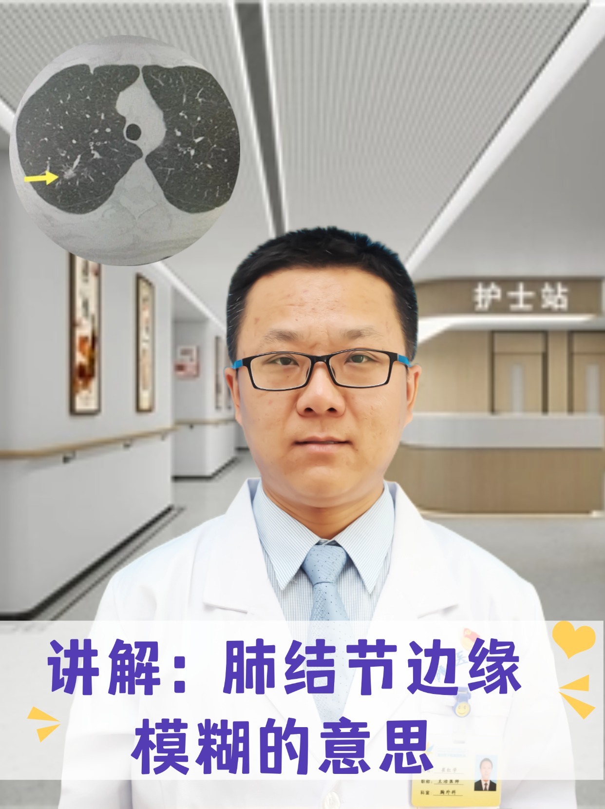 讲解：肺结节边缘模糊的意思