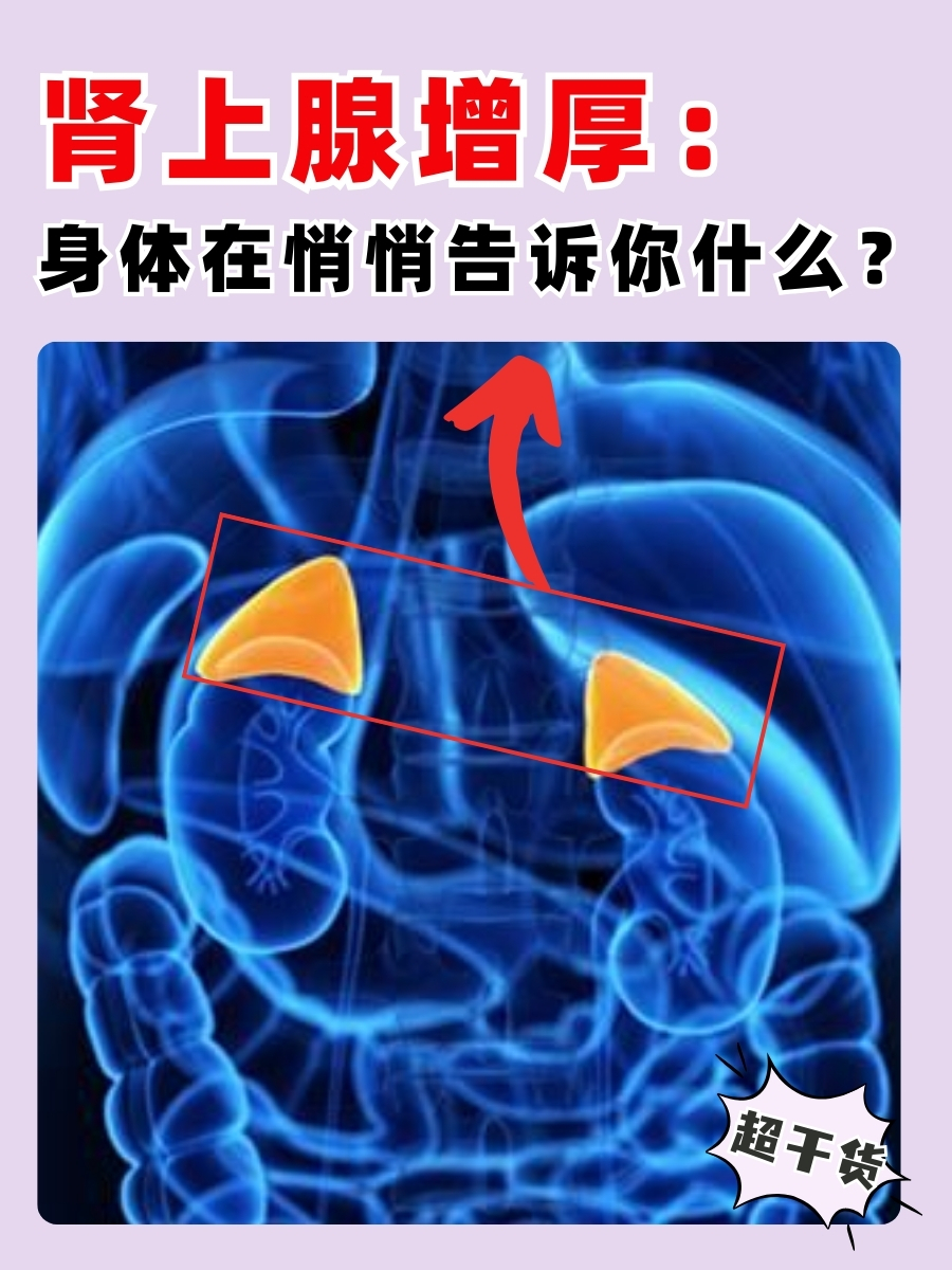 肾上腺增厚：身体在悄悄告诉你什么？