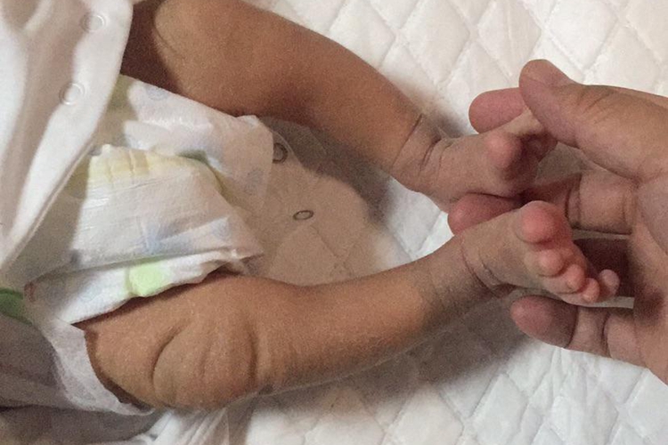 两个月宝宝小腿弯曲图 两个月宝宝小腿弯曲图