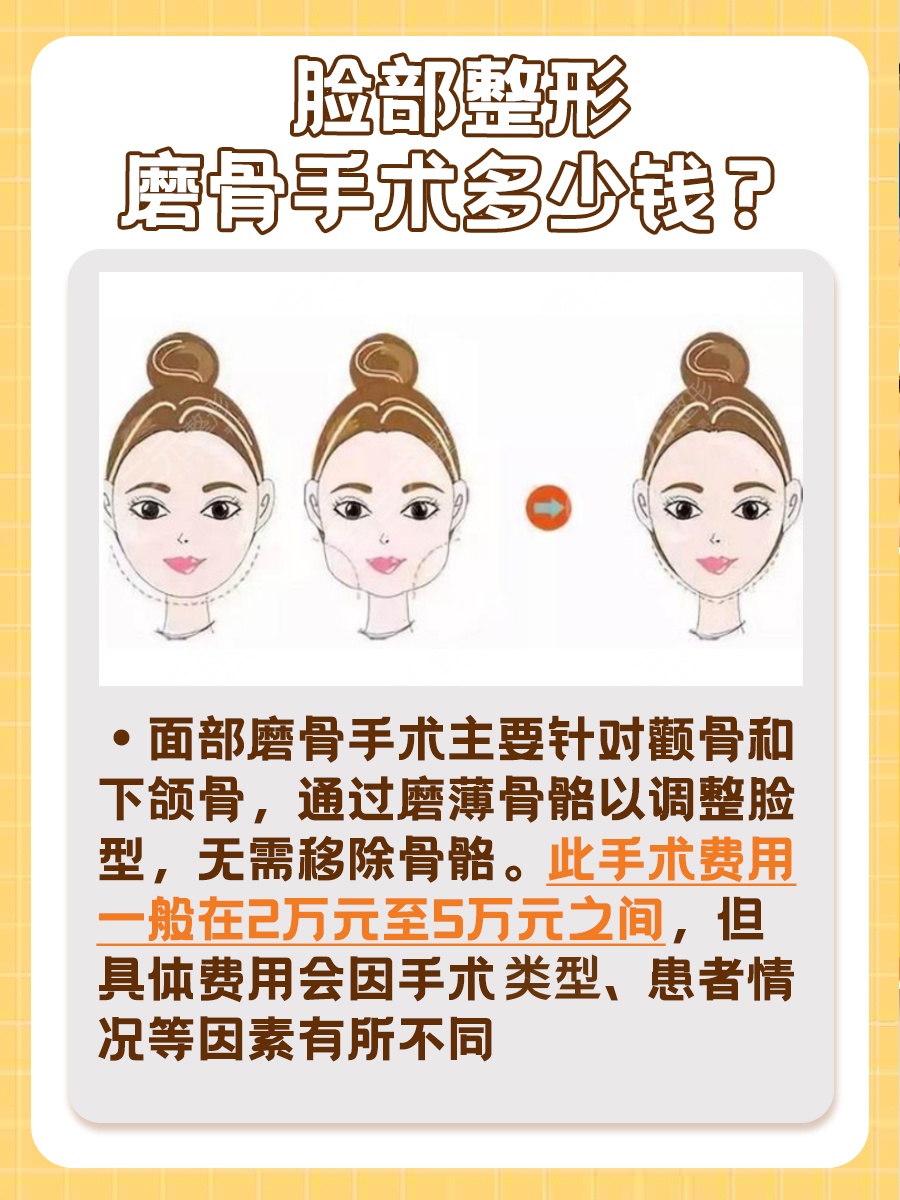 脸部整形磨骨手术,价格多少?
