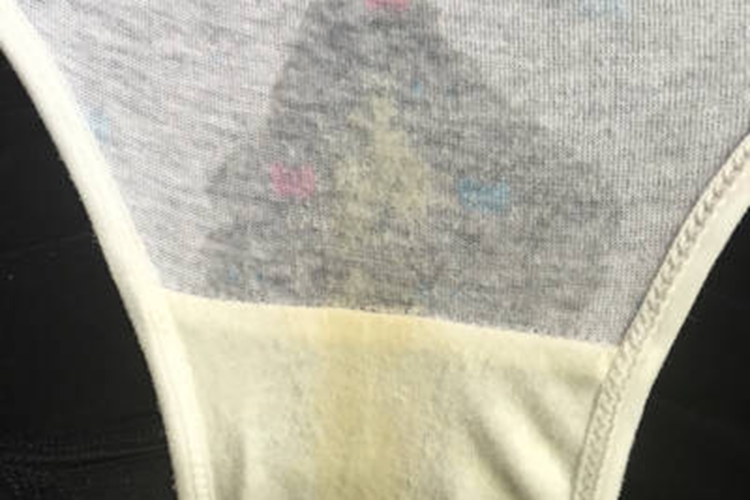 孕妇先兆临产破水图