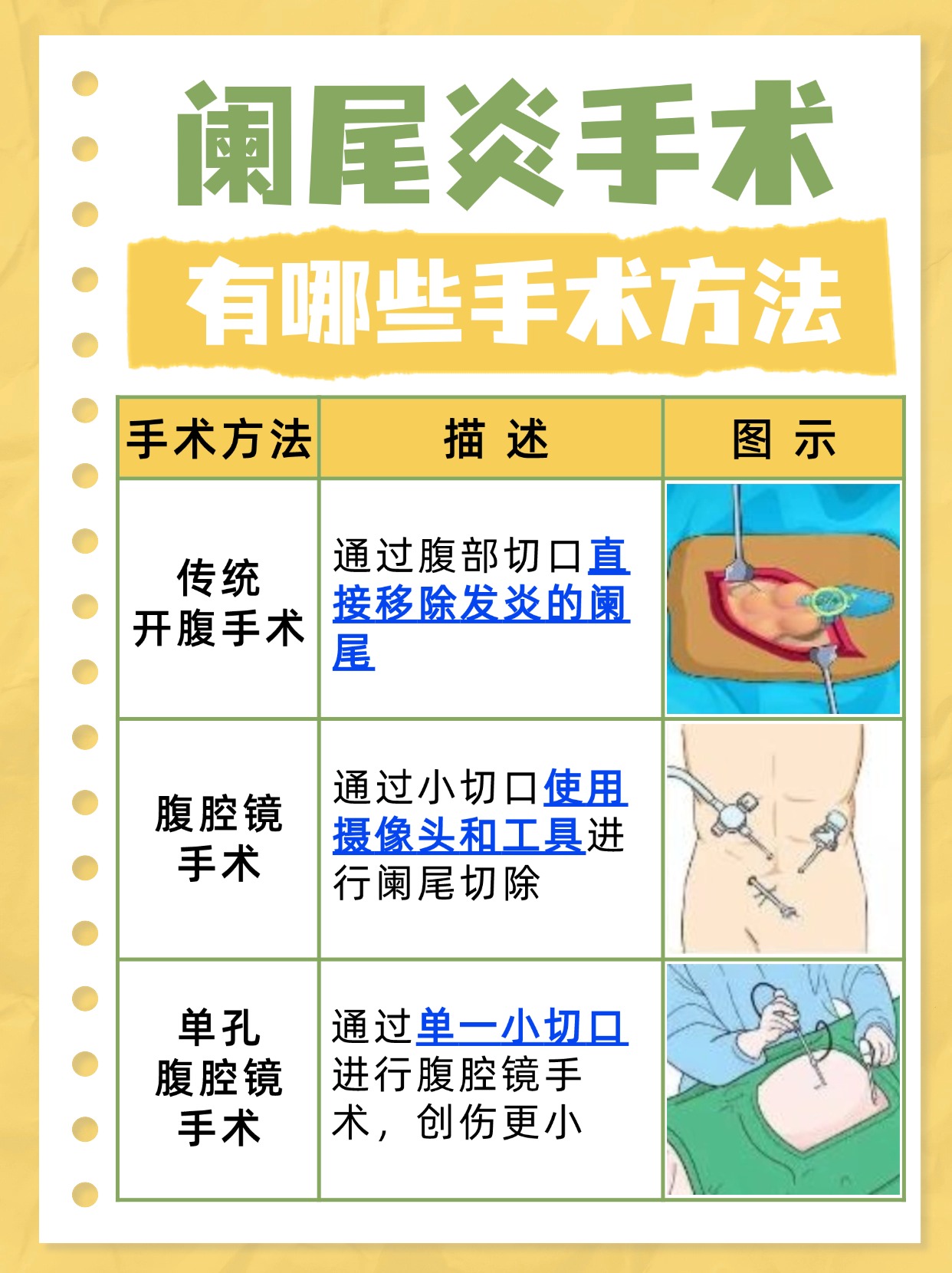 阑尾炎手术后多久可以剧烈运动?康复时间表