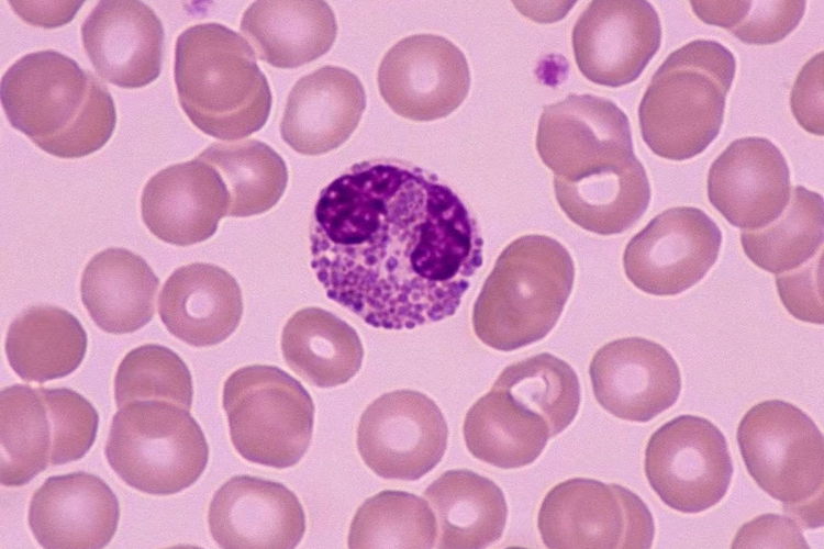 嗜酸性粒细胞图