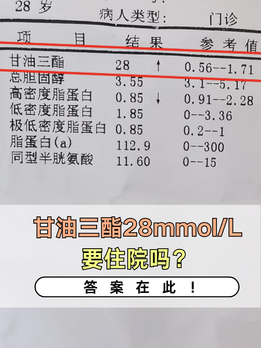 甘油三酯28mmol/L要住院吗？答案在此！