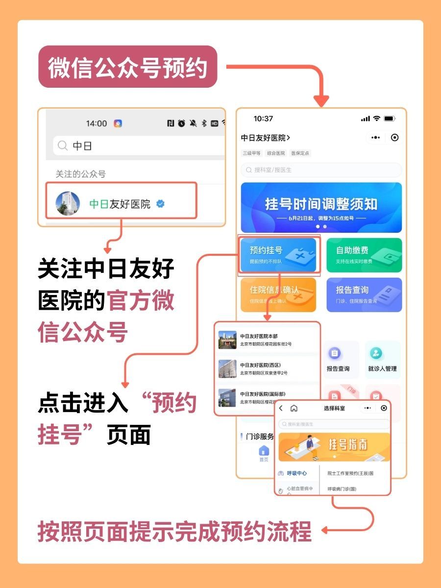 中日友好医院王非医生怎么样？怎么挂号？