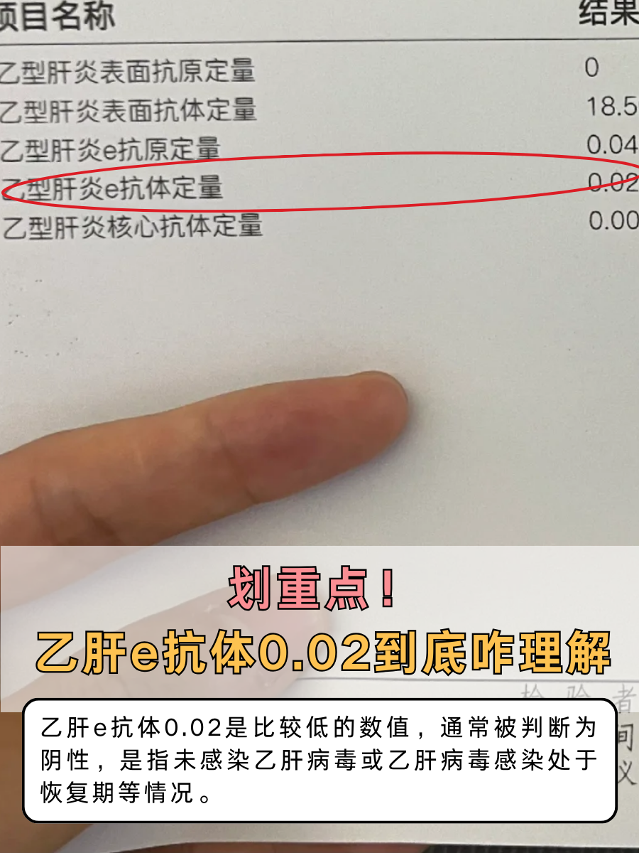 划重点！乙肝e抗体0.02到底咋理解