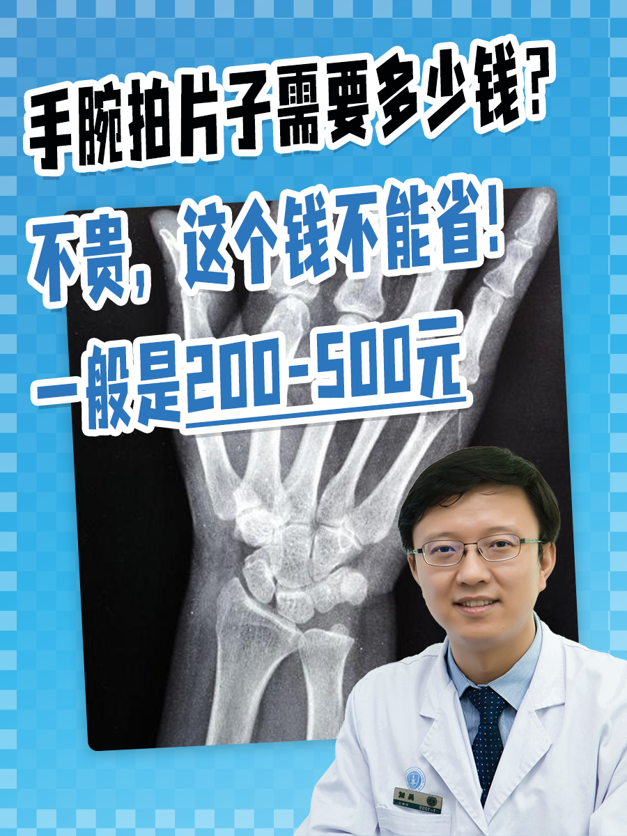 手腕拍片子需要多少钱？不贵，这个钱不能省！