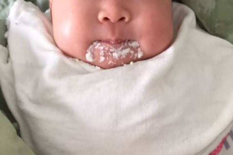 新生儿吐奶图