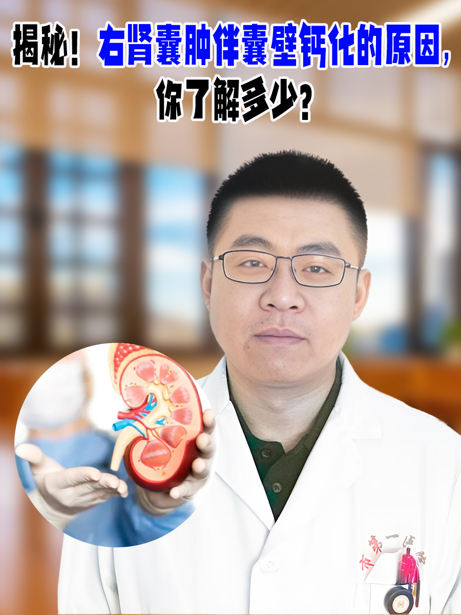 揭秘！右肾囊肿伴囊壁钙化的原因，你了解多少？