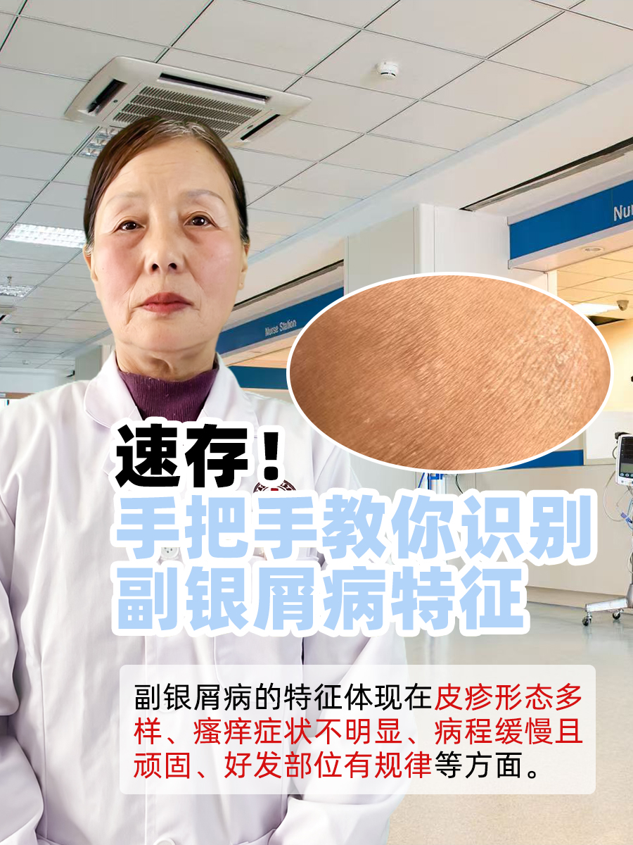 速存！手把手教你识别副银屑病特征