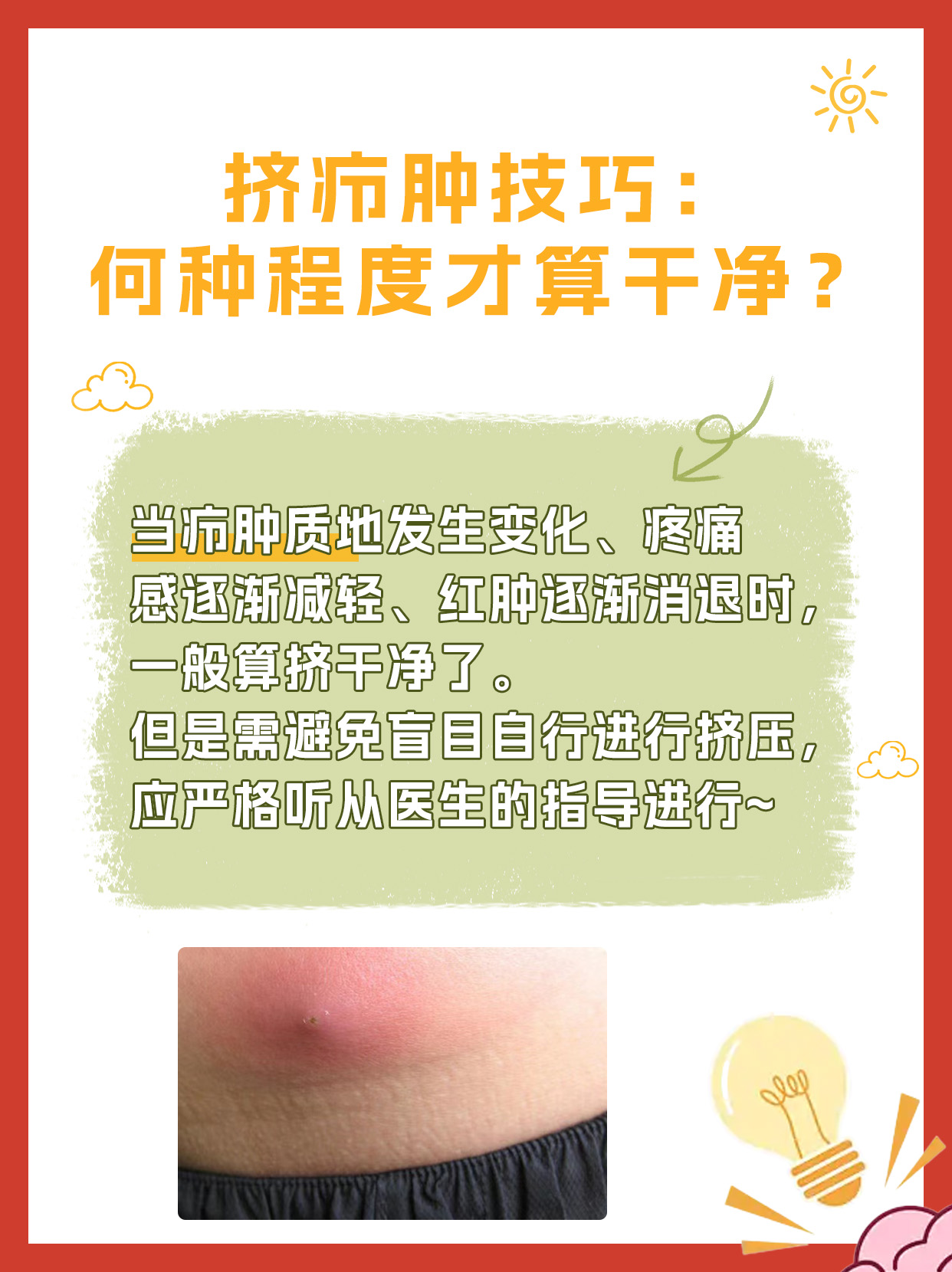 挤疖肿技巧:何种程度才算干净?