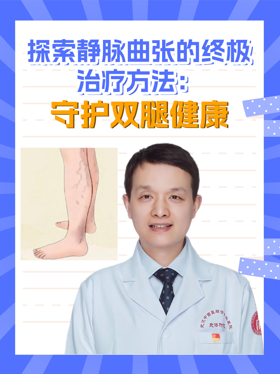 探索静脉曲张的终极治疗方法：守护双腿健康