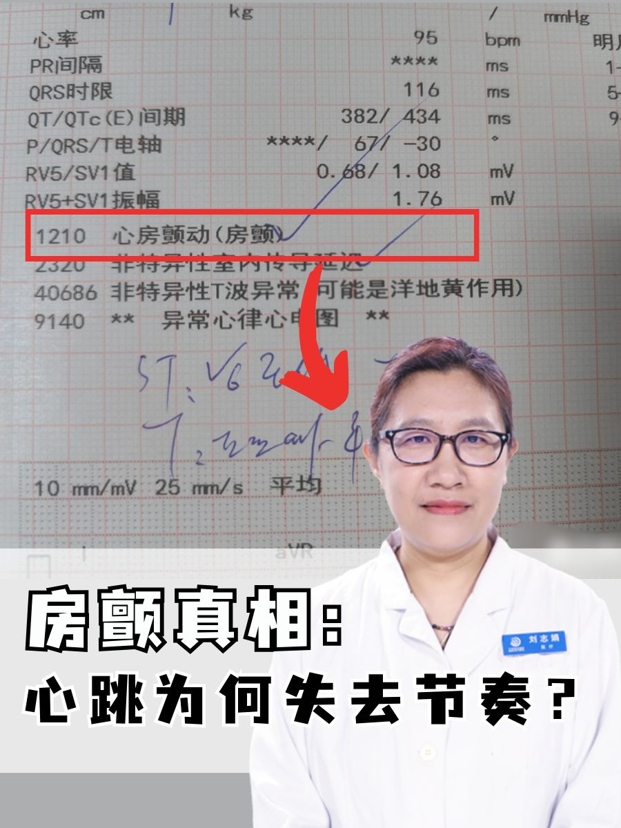 房颤求真相：心跳为何失去节奏？