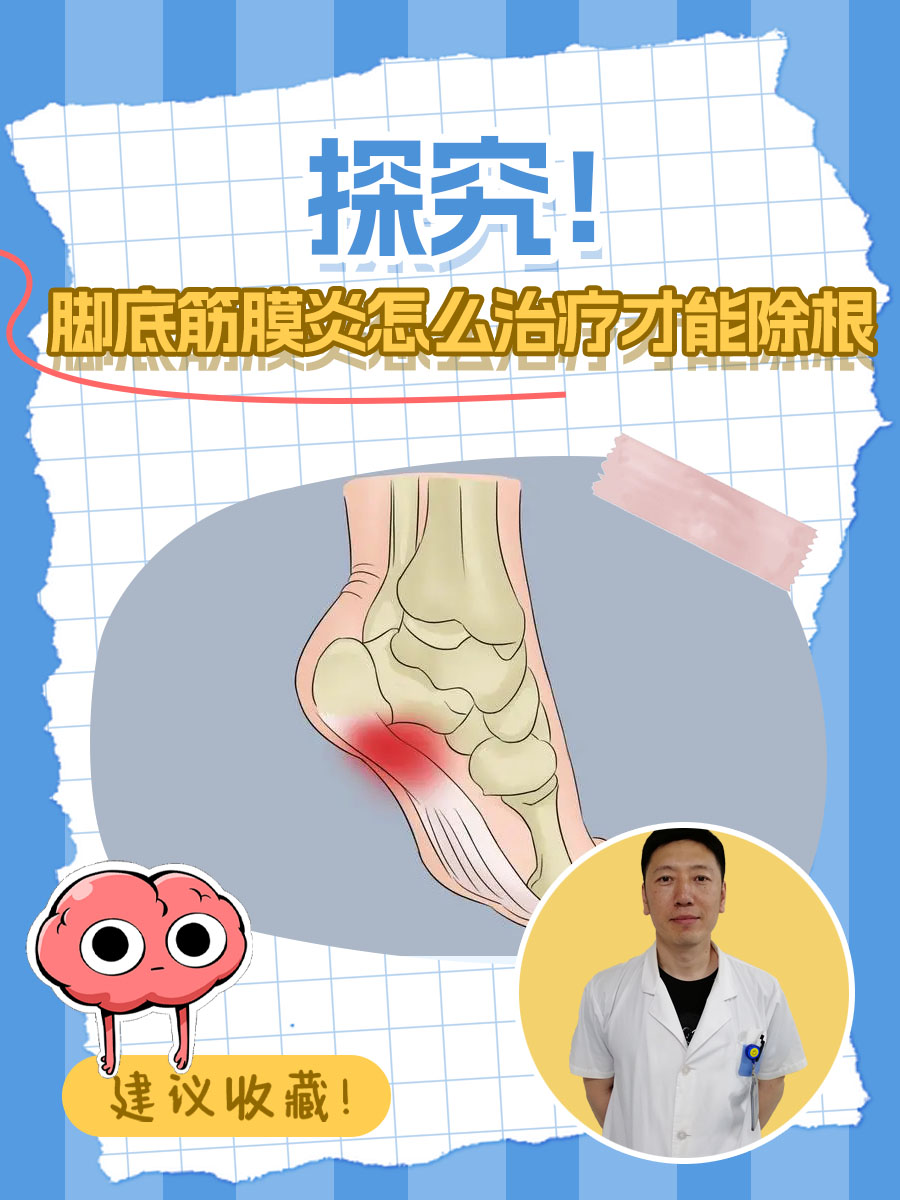 探究！脚底筋膜炎怎么治疗才能除根