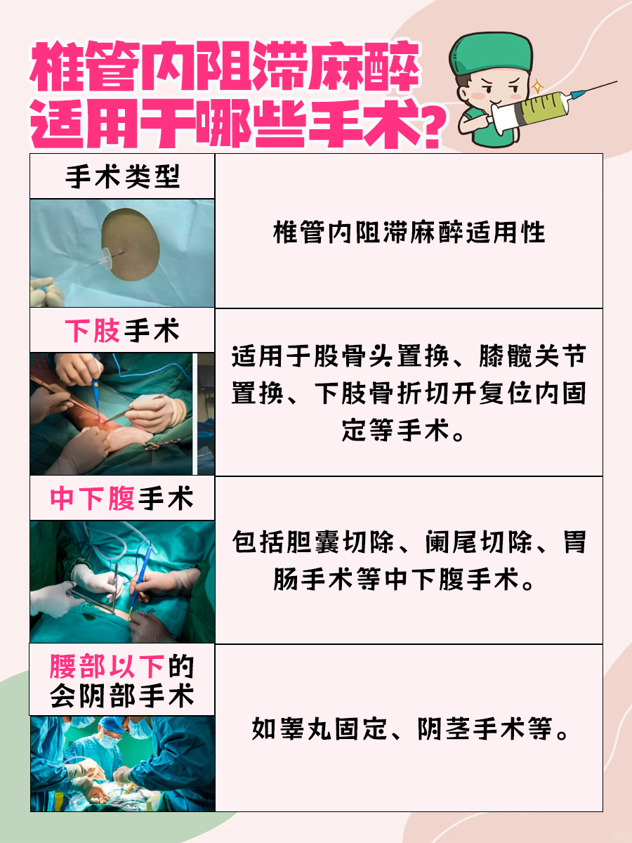 椎管内阻滞麻醉平面：轻松解读医学小常识