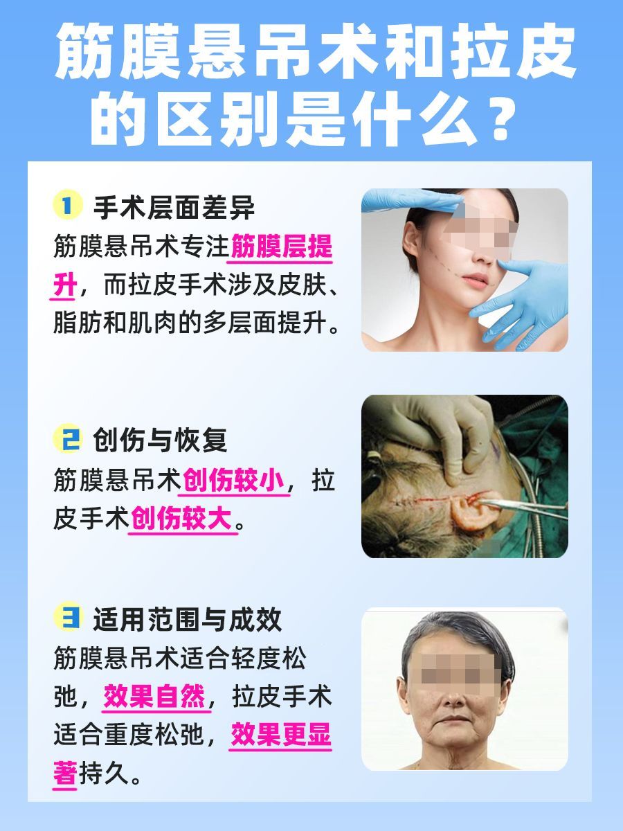 筋膜悬吊术和拉皮的区别是什么？医生告诉你