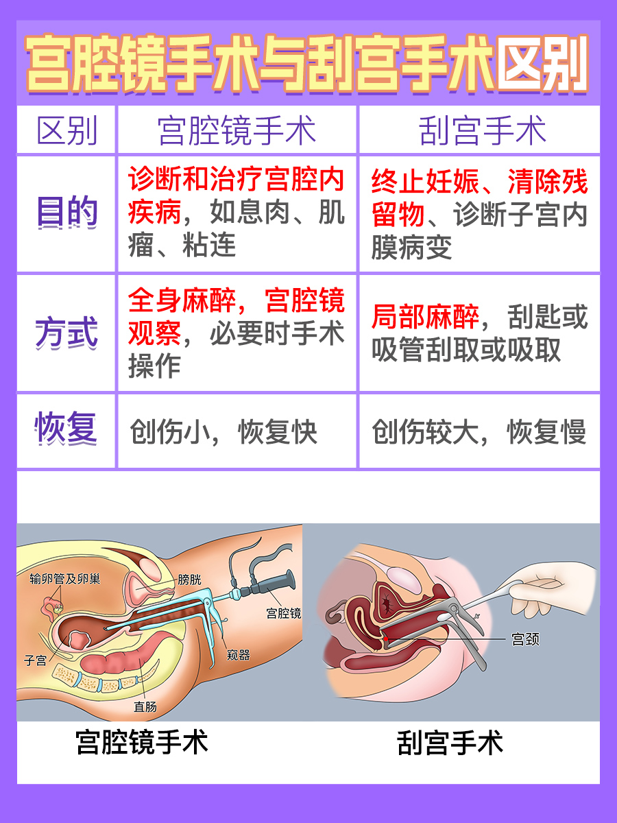 宫腔镜手术与刮宫手术有什么区别？