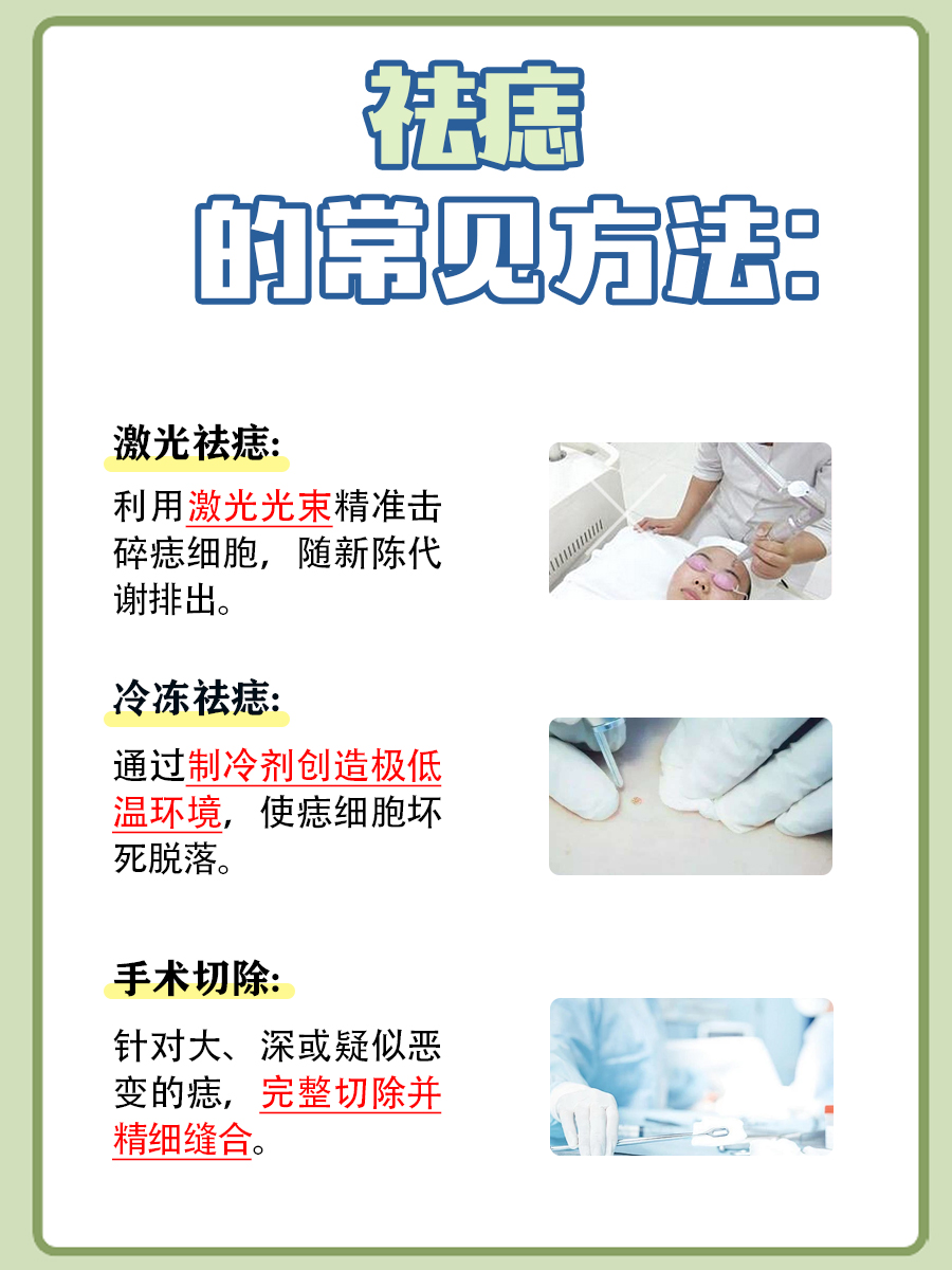 痣怎么去掉：科学解析祛痣原理