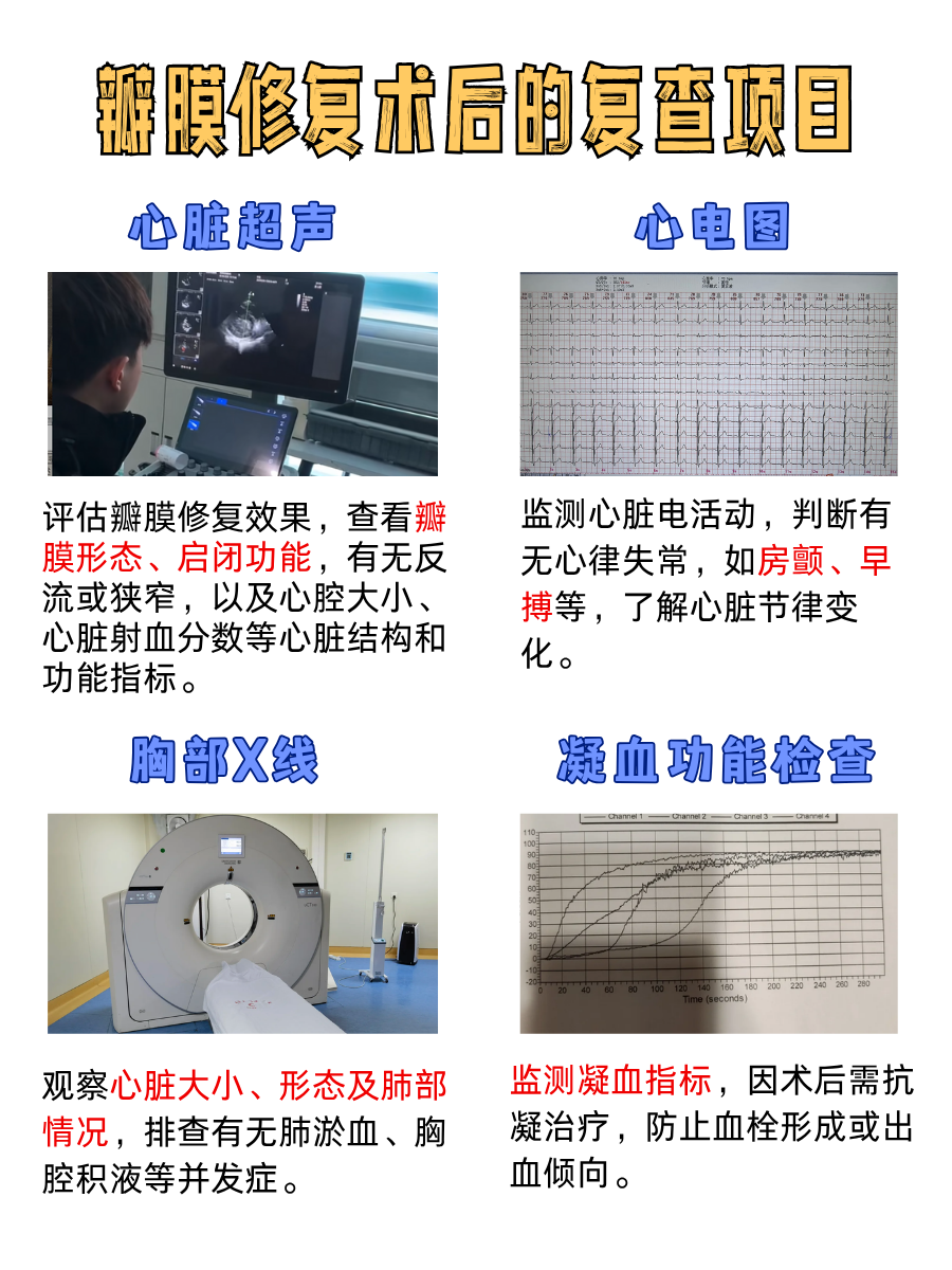 医生答疑：瓣膜修复术，真的需要开胸吗？