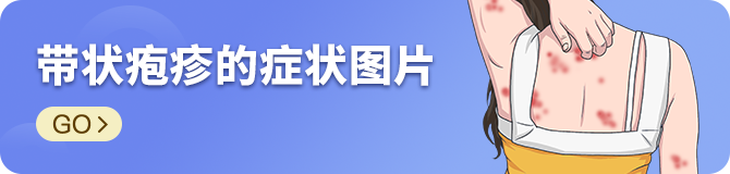 带状疱疹的症状图片