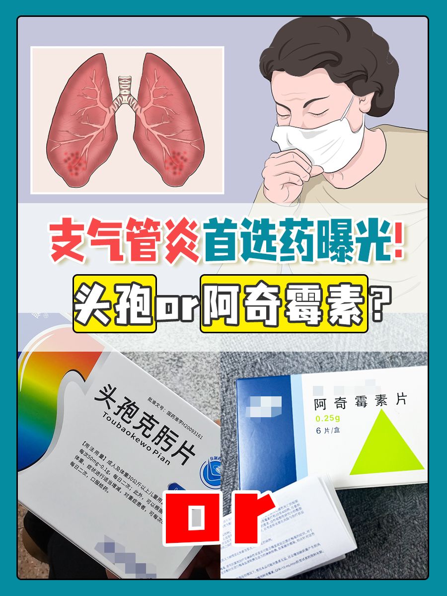 支气管炎首选药曝光!头孢or阿奇霉素?
