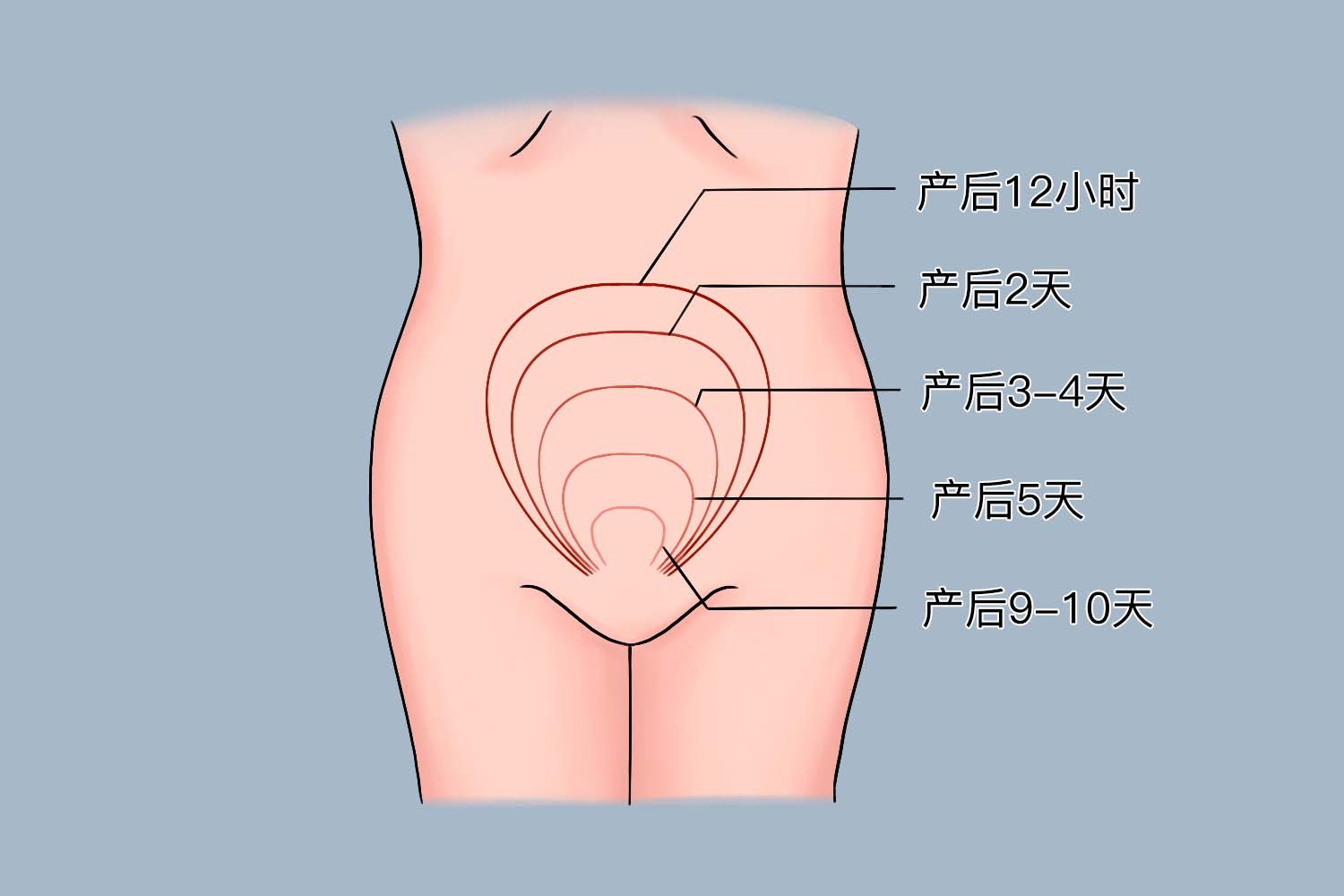 剖腹产后的子宫图片