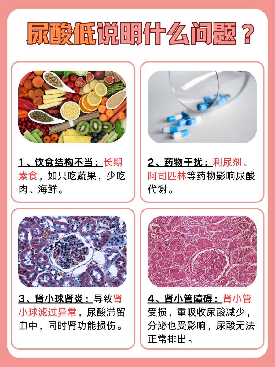 尿酸偏低，你的检查报告在暗示啥？