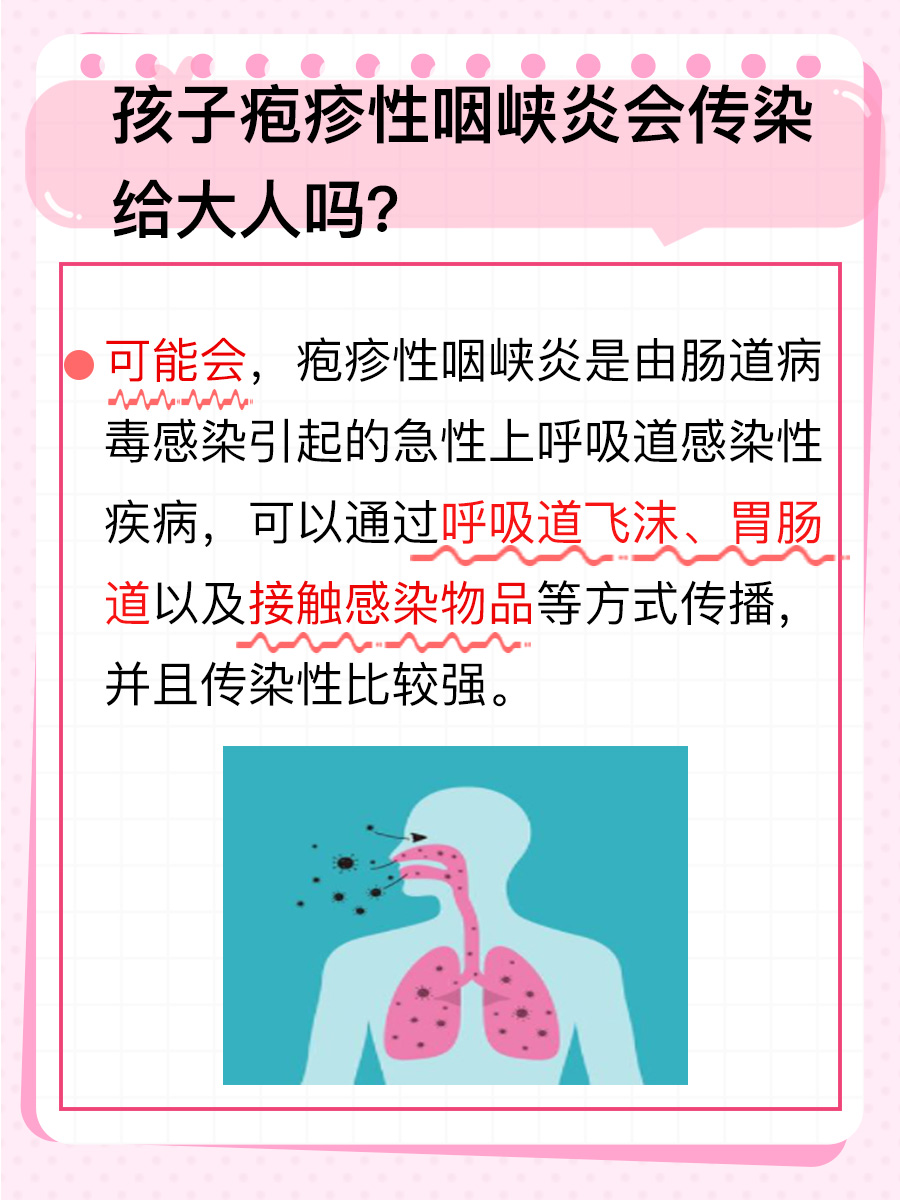 孩子疱疹性咽峡炎：会悄然传染给大人？
