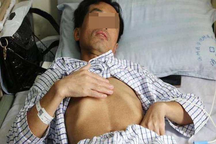 恶病质症状图 恶病质症状图