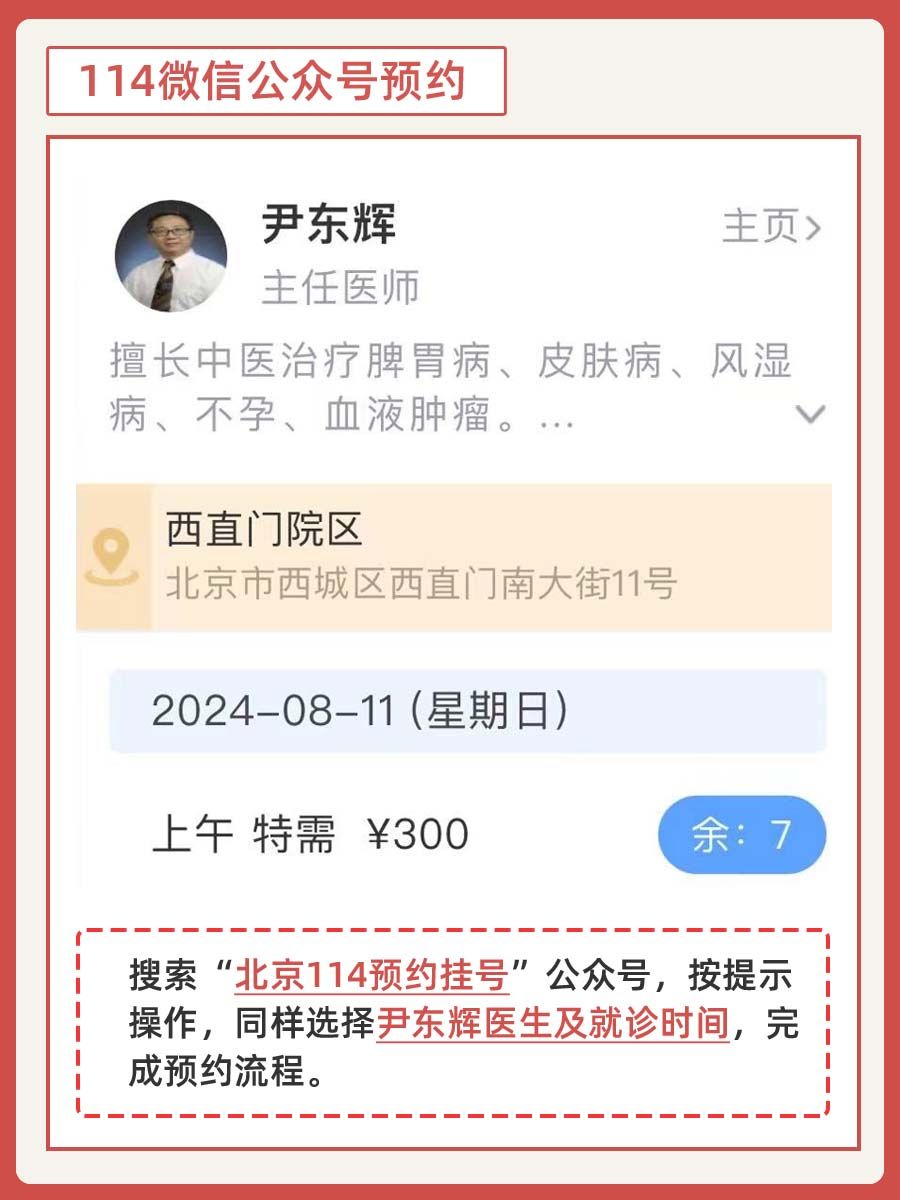 北大人民医院尹东辉医生怎么样?怎么挂号?