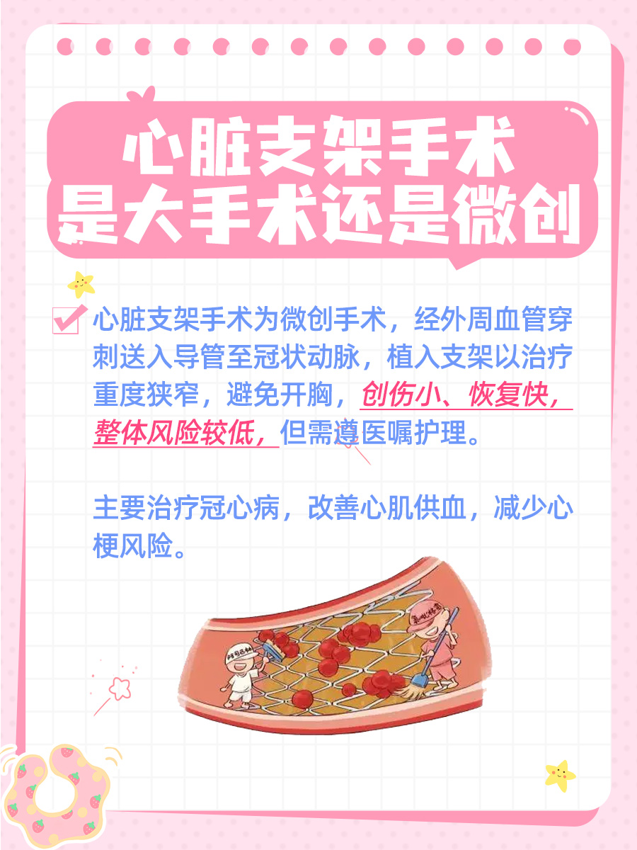 心脏支架手术是大手术还是微创,专家解答