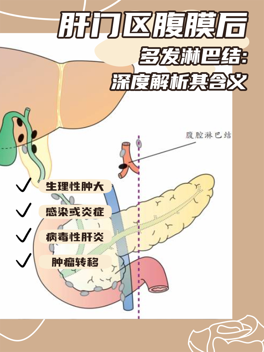 肝门区腹膜后多发淋巴结：深度解析其含义