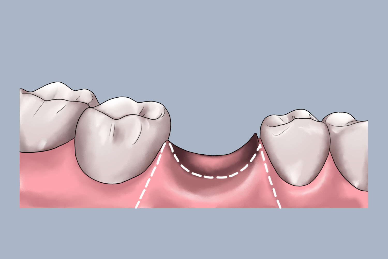完整种植面图 完整种植面图