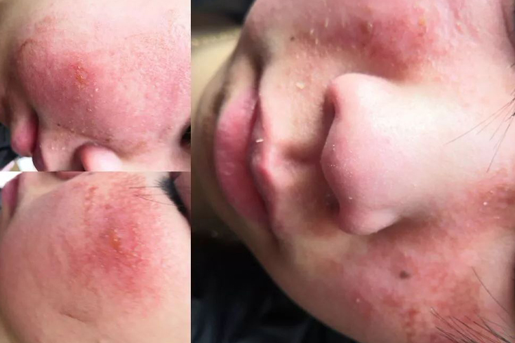 湿性型脸上面游风图