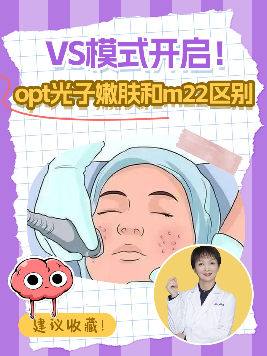 VS模式开启！opt光子嫩肤和m22区别