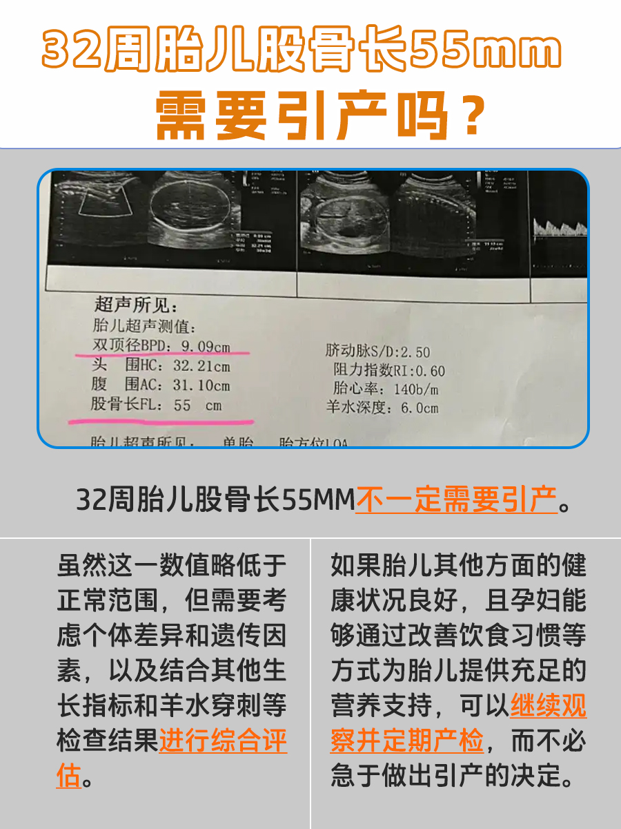 32周股骨长55mm,真的需要引产吗?