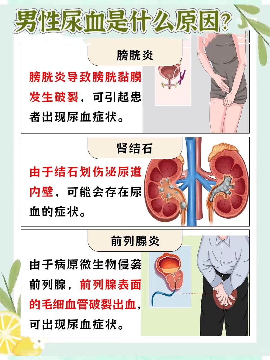 男性尿血，背后隐藏的健康警讯！