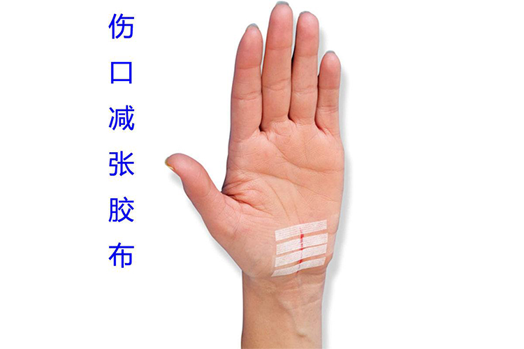 伤口拉合胶布效果图