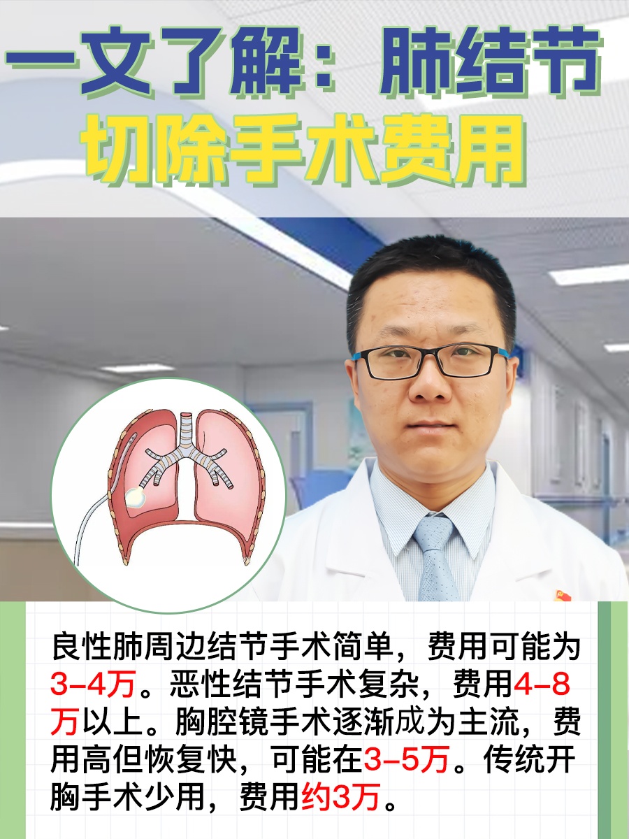 一文了解：肺结节切除手术费用