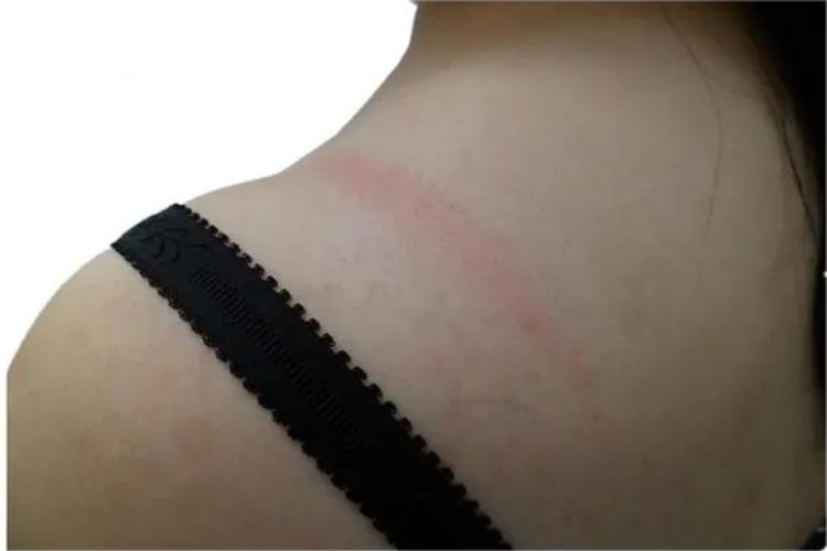 正常内衣压痕图