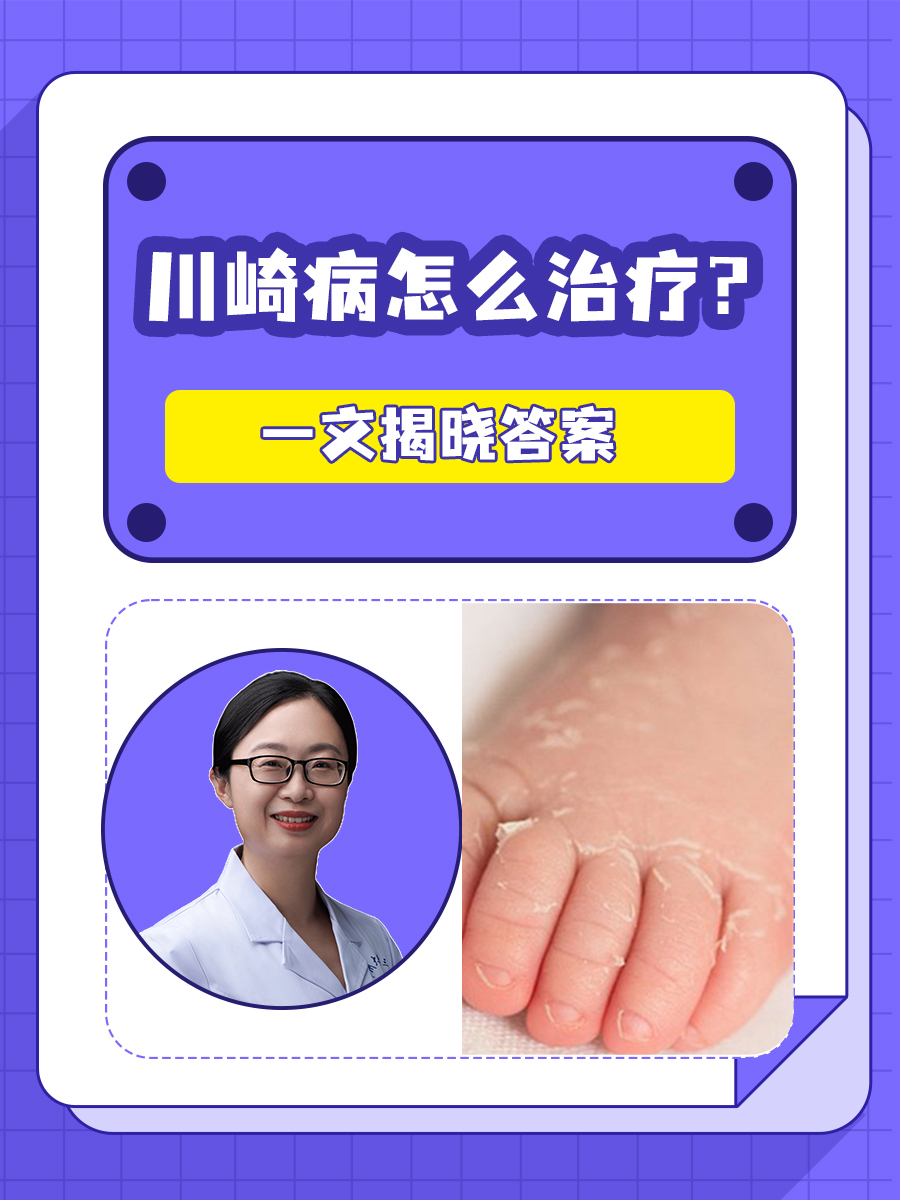 川崎病怎么治疗?一文揭晓答案
