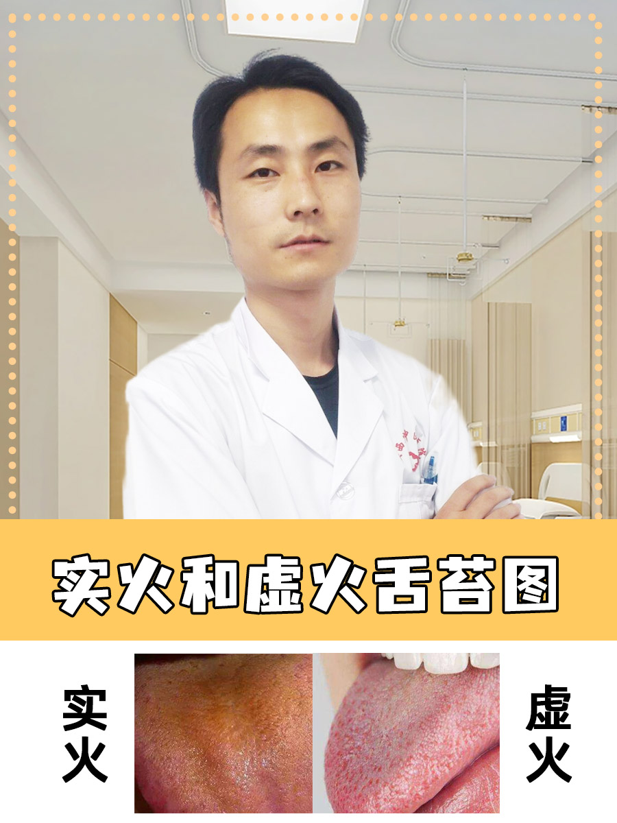 实火和虚火舌苔图