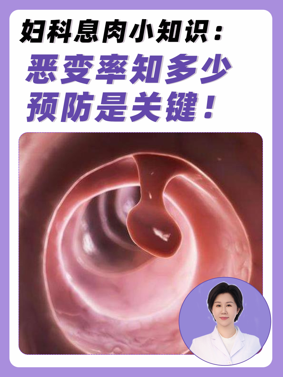 妇科息肉小知识：恶变率知多少，预防是关键！