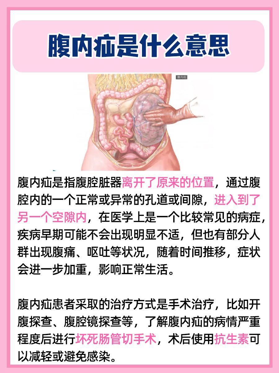 腹内疝揭秘：藏在肚子里的“秘密通道”