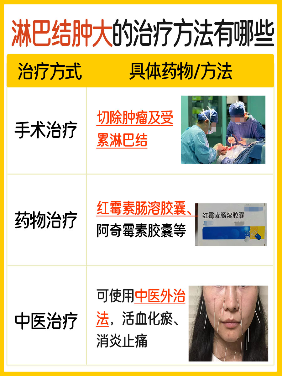 揭秘：摸着什么感觉才是淋巴结肿大