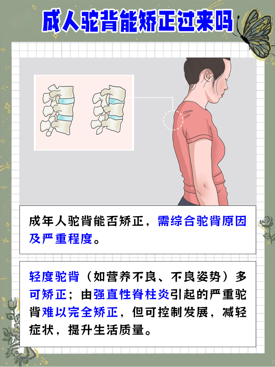 专家带你了解，成人驼背能矫正过来吗