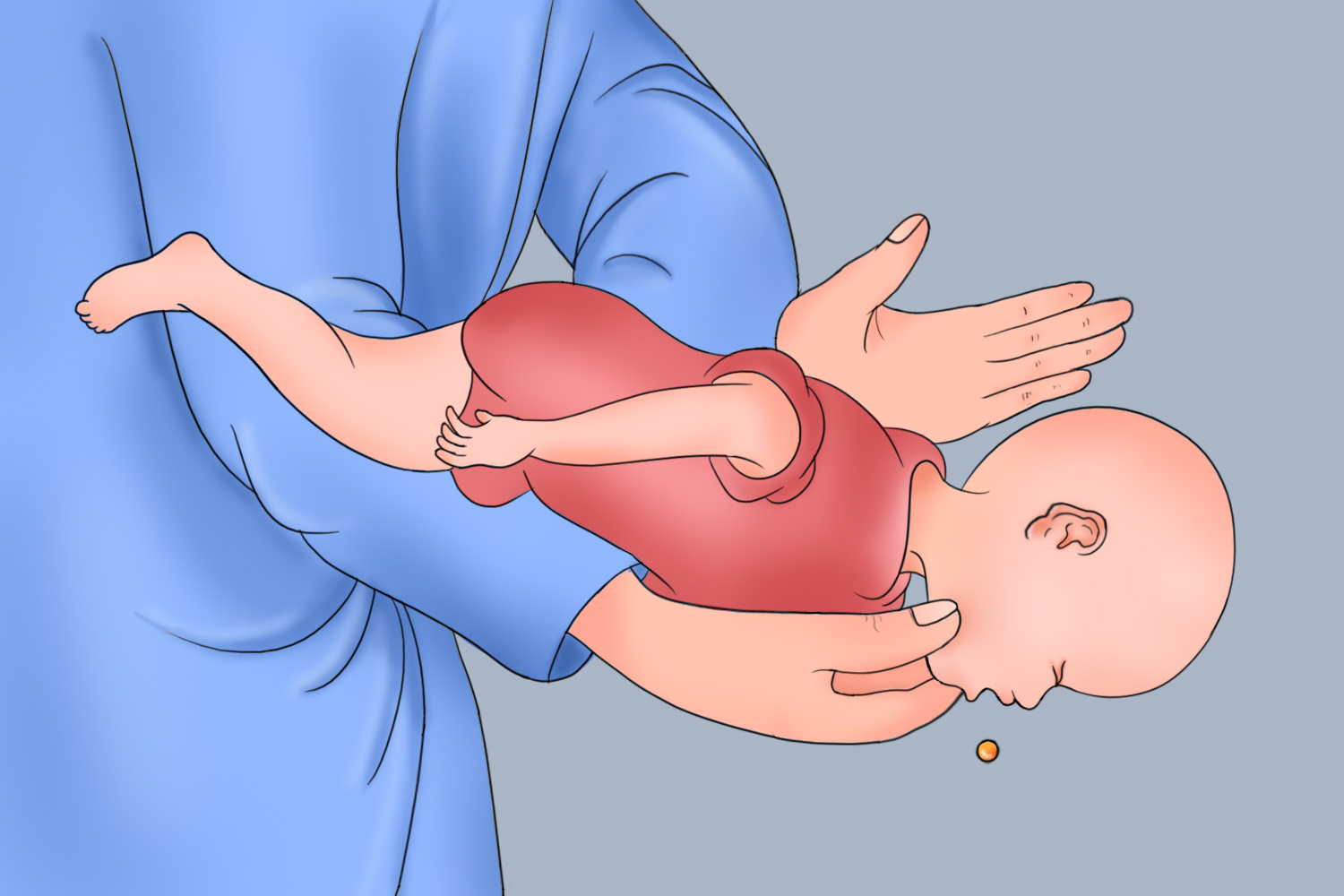 婴儿吐奶急救姿势图